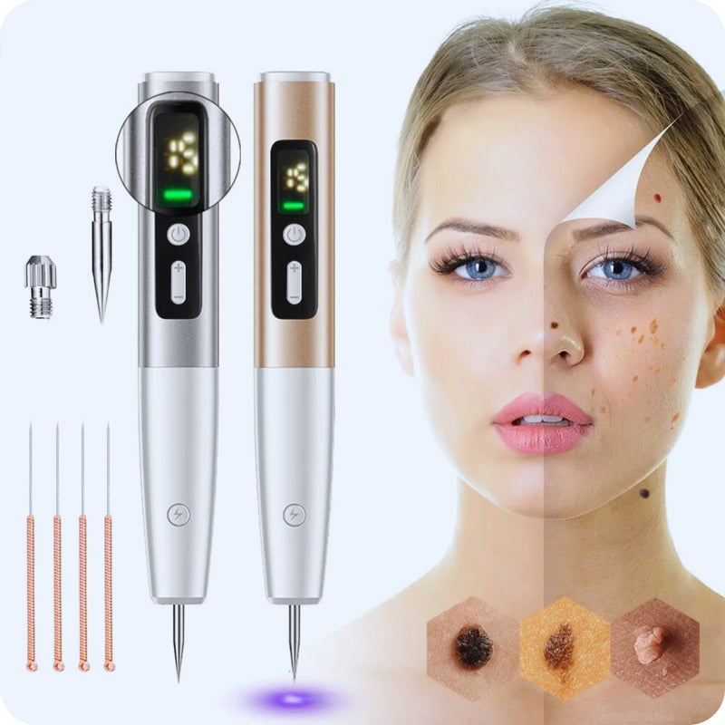 Caneta de Plasma a Laser com Led - Remoção de Imperfeições, Manchas, Sardas e Espinhas - Pele Renovada