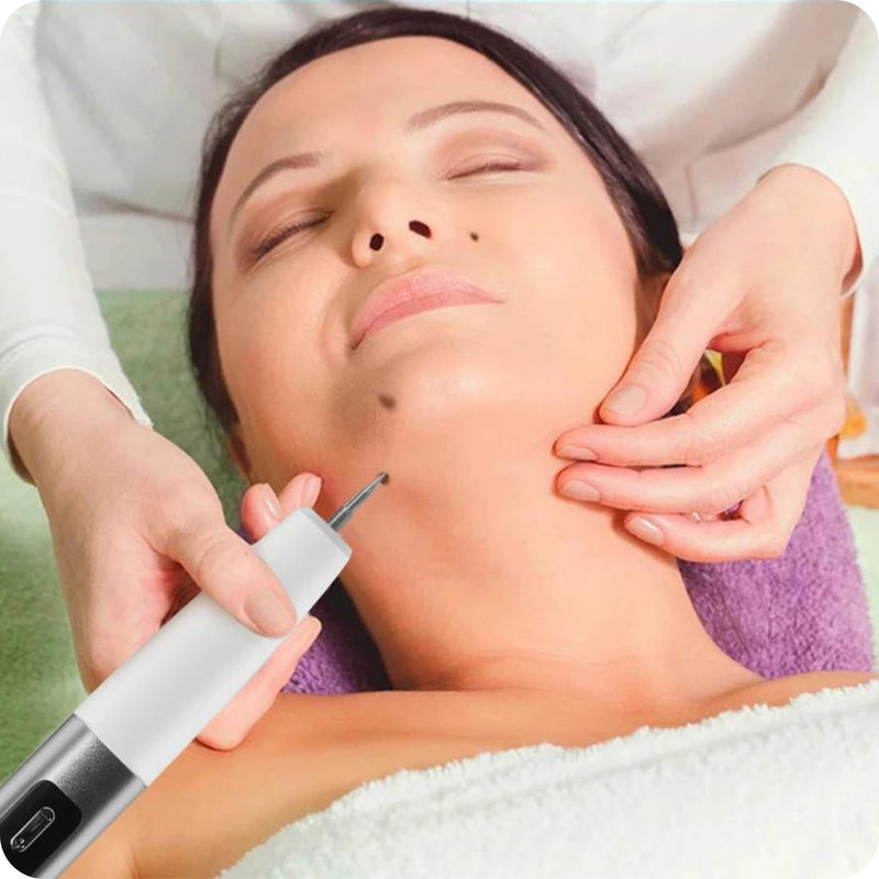 Caneta de Plasma a Laser com Led - Remoção de Imperfeições, Manchas, Sardas e Espinhas - Pele Renovada